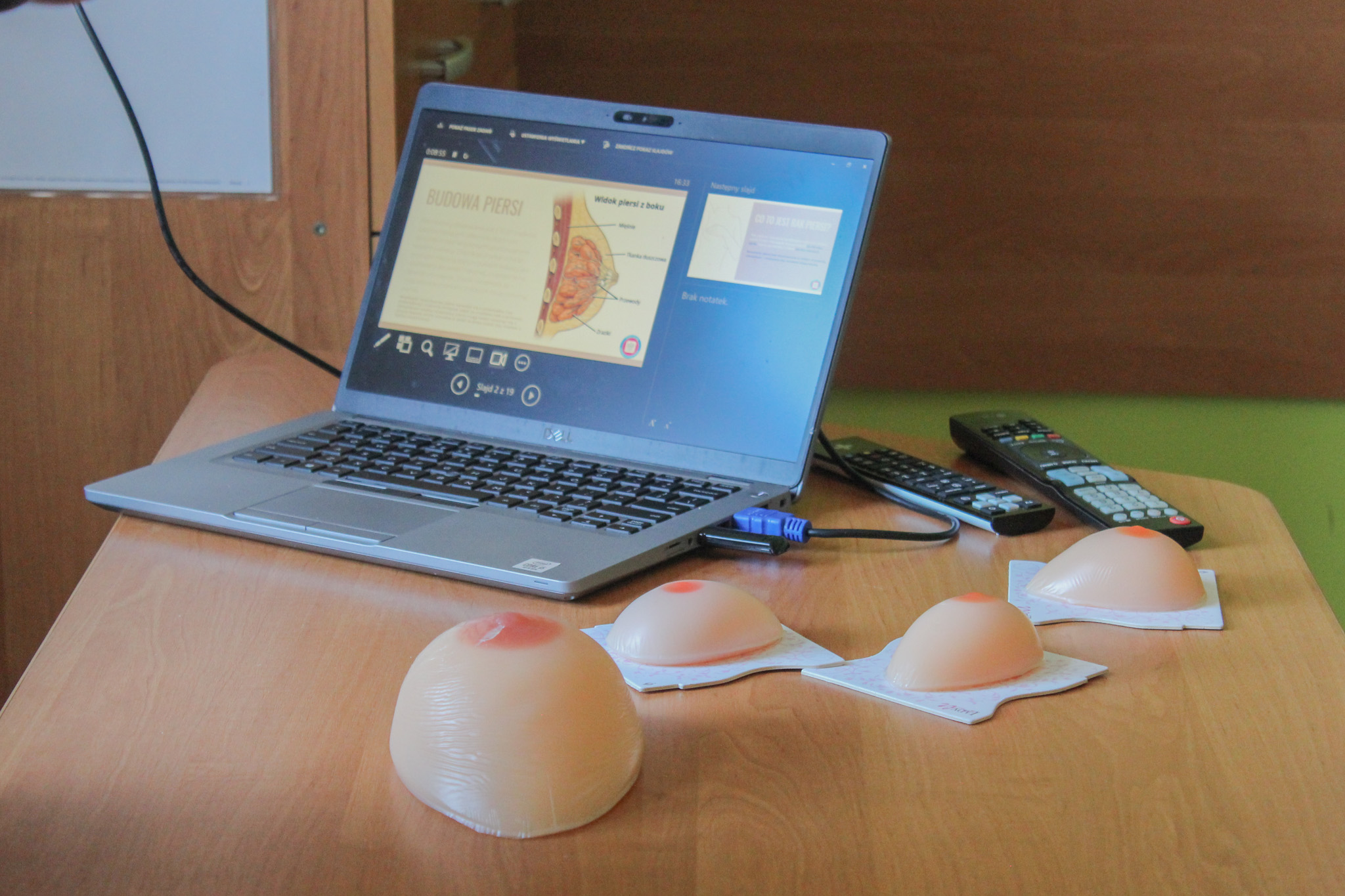 Spotkanie - profilaktyk raka piersi